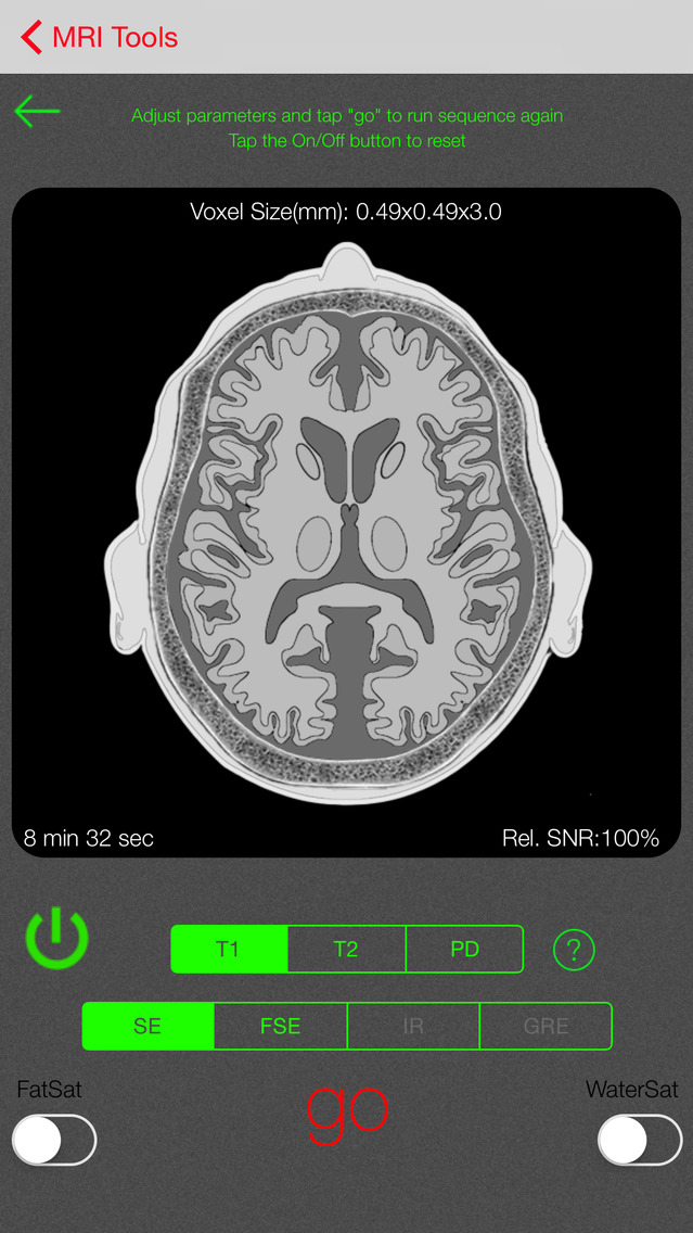 iRad MRI screenshot1