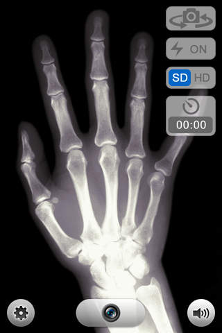X-Ray Vision 的X射线视觉