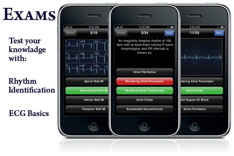 免費下載音樂APP|Instant ECG: An Electrocardiogram Rhythms Interpretation Guide app開箱文|APP開箱王