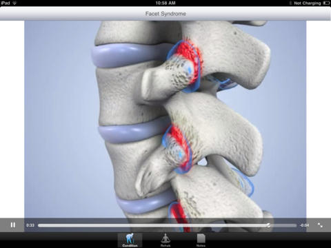 Facet Joints for iPad