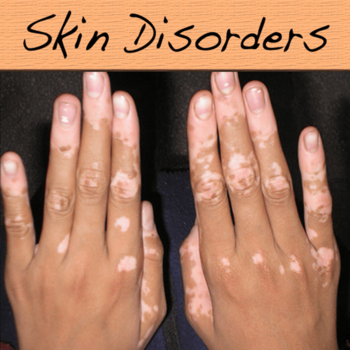 Most Skin Disorders LOGO-APP點子