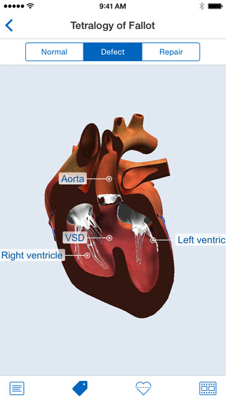 【免費醫療App】Heartpedia-APP點子