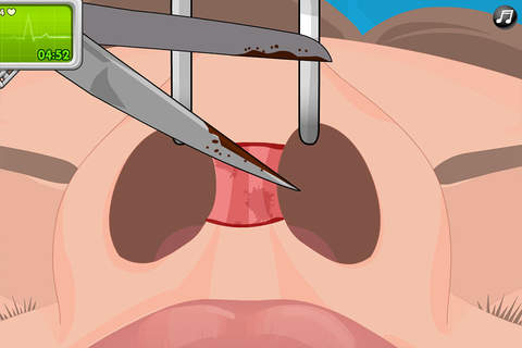 Operate Now Nose Surgery screenshot 4