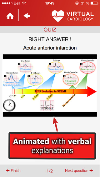 【免費醫療App】Virtual Cardiology by McGill University cardiologists and cardiologists from‎ Université Laval-APP點子