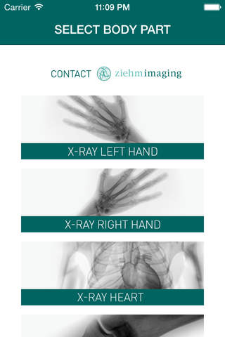 Pocket X-ray scanner by Ziehm Imaging (for entertainment purpose) screenshot 2