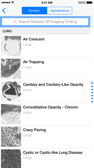 【免費醫療App】Thoracic Radiology Differential Diagnosis Lists-APP點子