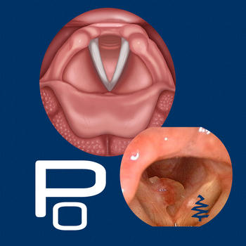 Vocal Pathology: Polyps 教育 App LOGO-APP開箱王
