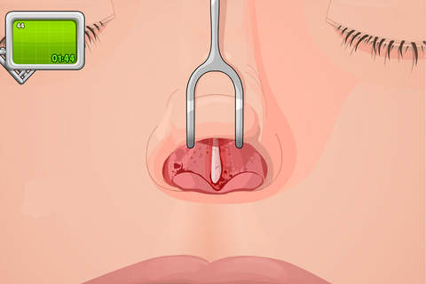 Operate Now Nose Surgery screenshot 3