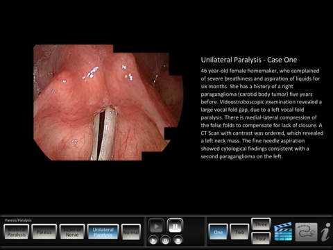 【免費教育App】Vocal Pathology: Paresis/Paralysis-APP點子