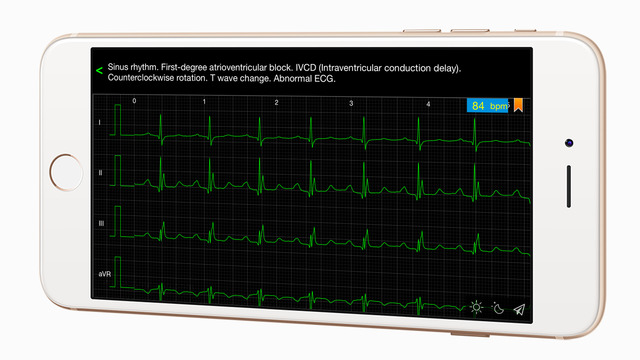 ECG Cases - 12 Lead electrocardiogram EKG for cardiology study