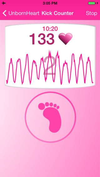 免費下載健康APP|Fetal Doppler UnbornHeart app開箱文|APP開箱王