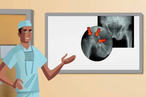 Hip Surgery Simulation screenshot 2