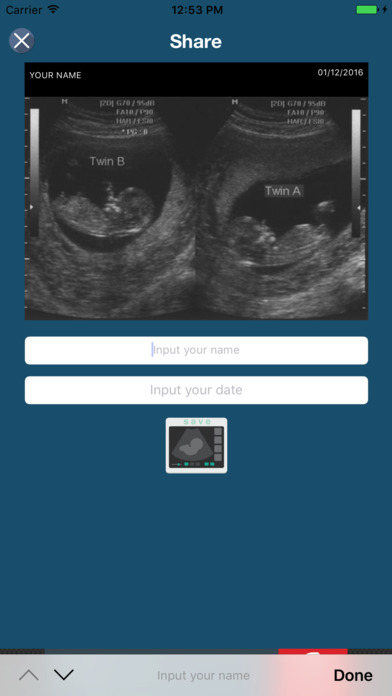 Pregnancy ultrasound screenshot 3