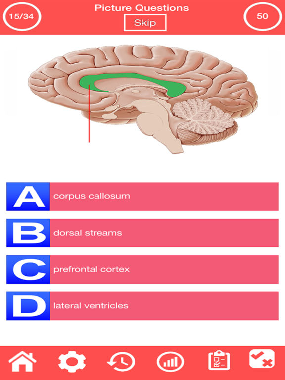 nervous-system-quiz-review-and-discussion-toucharcade