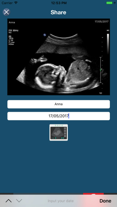 Pregnancy ultrasound screenshot 2