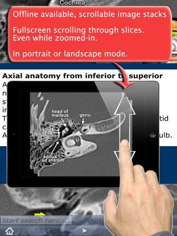 Radiology Assistant for iPad - Imaging Reference screenshot 3