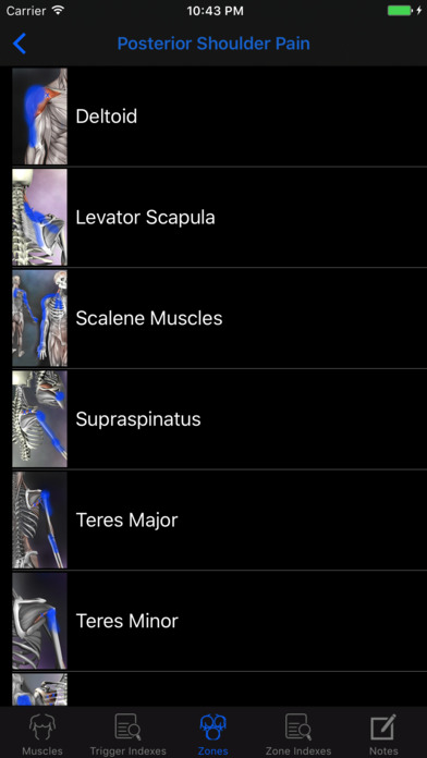 Muscle Trigger Points: Guide & Reference screenshot 4