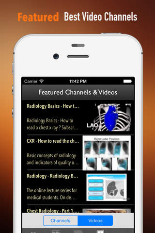 Radiology Study Guide: Exam Prep Courses with Glossary screenshot 3