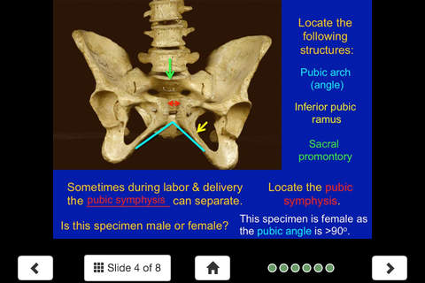 MSK Anatomy Lite - SecondLook screenshot 4