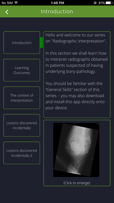 Bone Lesions screenshot 2