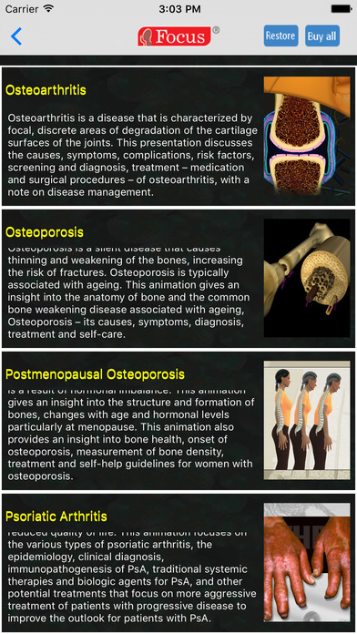 Orthopaedics - Understanding Disease screenshot 2