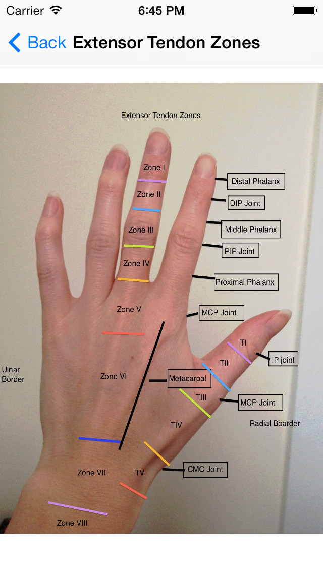 Crushing Injury Of Hand Icd 10 at Brian Futrell blog