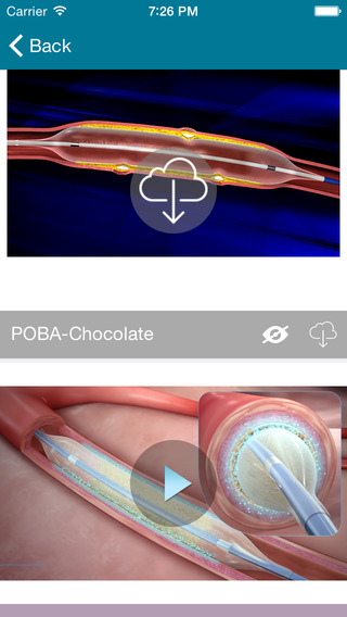 免費下載醫療APP|Cardio-Visual Lite app開箱文|APP開箱王