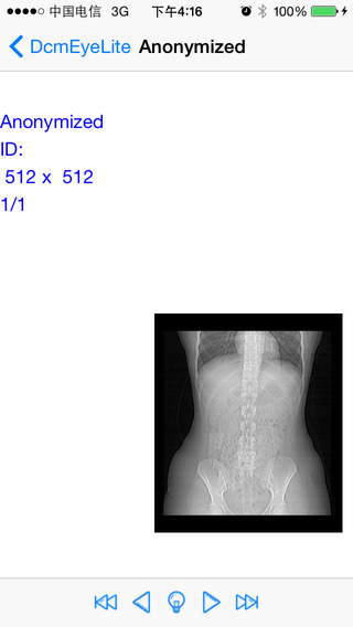 【免費醫療App】DcmEye Lite 2-APP點子