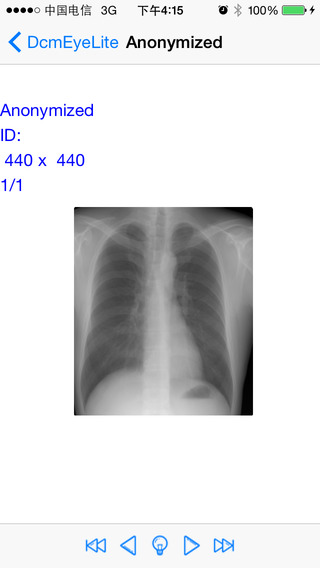 【免費醫療App】DcmEye Lite 2-APP點子