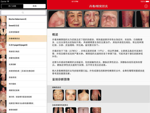 【免費醫療App】Derm101 Point of Care: 皮肤诊疗助手-APP點子