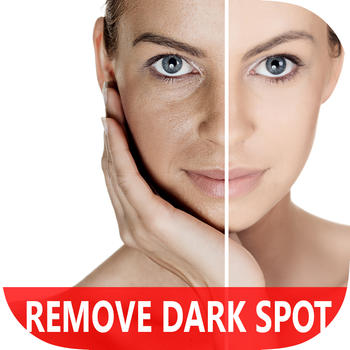 Get Rid Of Dark Spot LOGO-APP點子