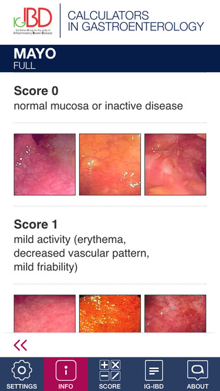 【免費醫療App】IGIBD Scores-APP點子