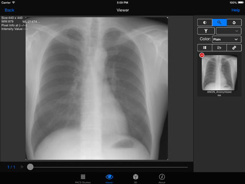 【免費醫療App】Pacs Dicom Viewer-APP點子