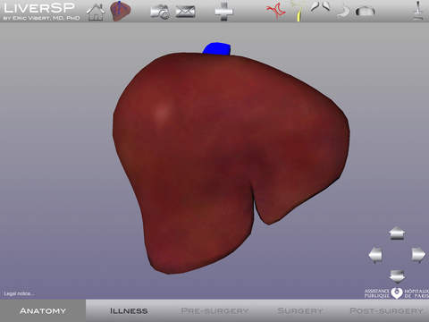 Chirurgie du foie AP-HP screenshot 2