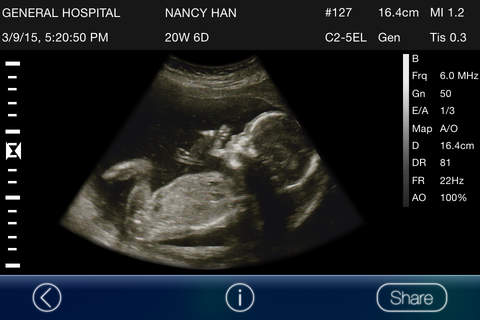 Mom, I'm pregnant - Ultrasound Prank screenshot 2