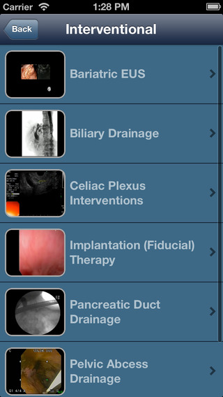 【免費醫療App】EUS - Diagnostic and Interventional Endoscopic Ultrasound-APP點子