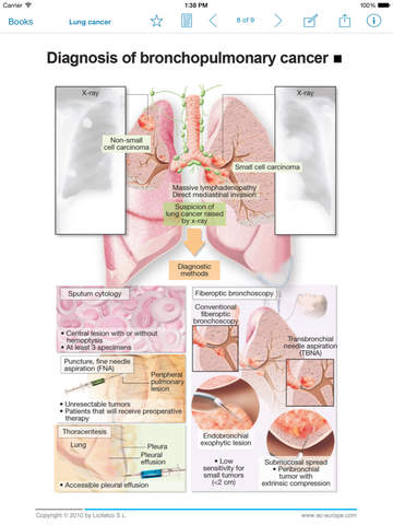 【免費醫療App】Miniatlas Lung Cancer-APP點子