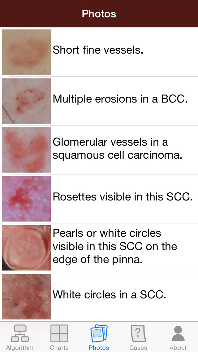 Dermoscopy Two Step Algorithm | Apps | 148Apps