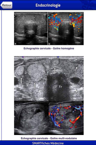 SMARTfiches Endocrinologie - náhled