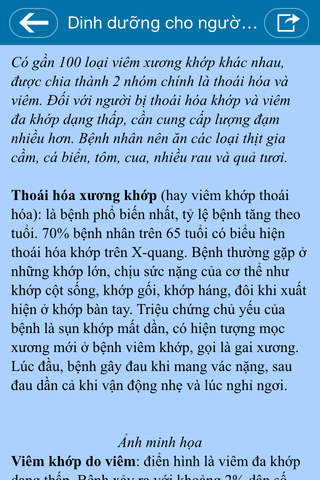 Bệnh Xương Khớp - náhled